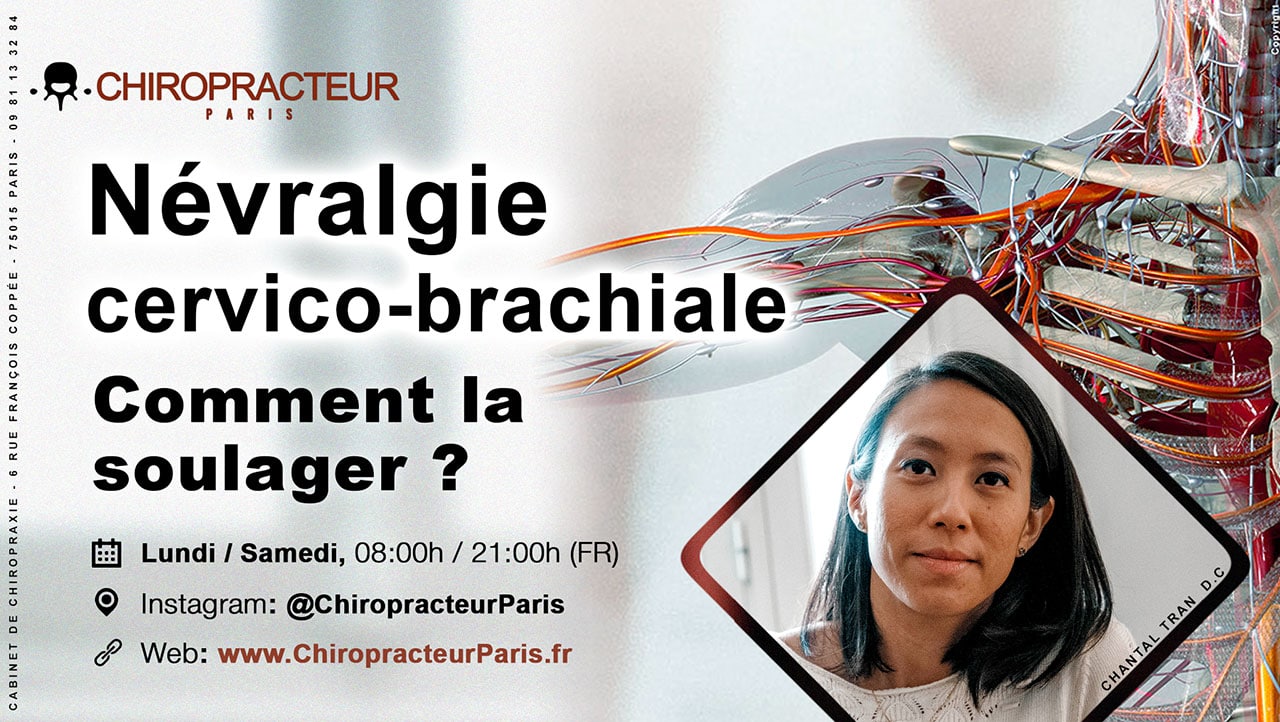La névralgie cervico-brachiale - Chiropraxie Paris™